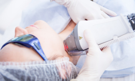 準(zhǔn)分子激光 準(zhǔn)分子激光